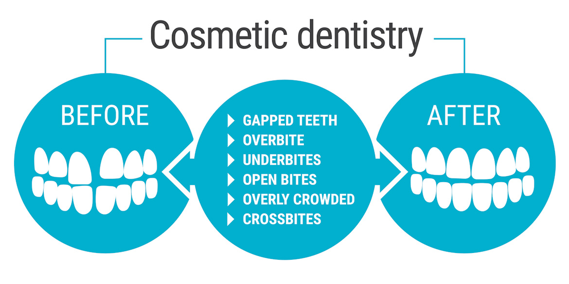 cosmetic dentistry chart