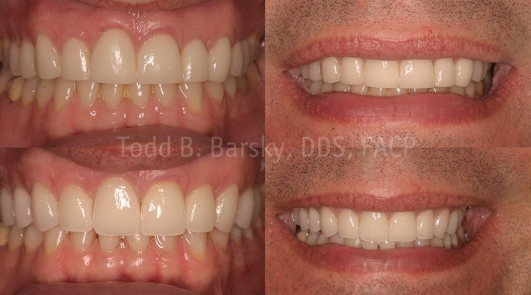 Cosmetic Dentistry & Complete Smile Makeovers in Miami | Barsky DDS